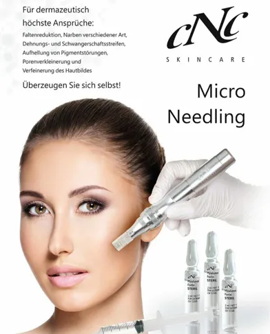 Anti Age Lifting – Lifting ohne OP
